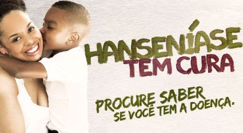 Eusébio promove Campanha contra Hanseníase, Geo-helmintíase e Tracoma